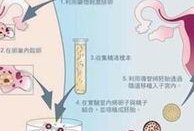 睾丸取精比显微取精的试管婴儿成功率高吗？
